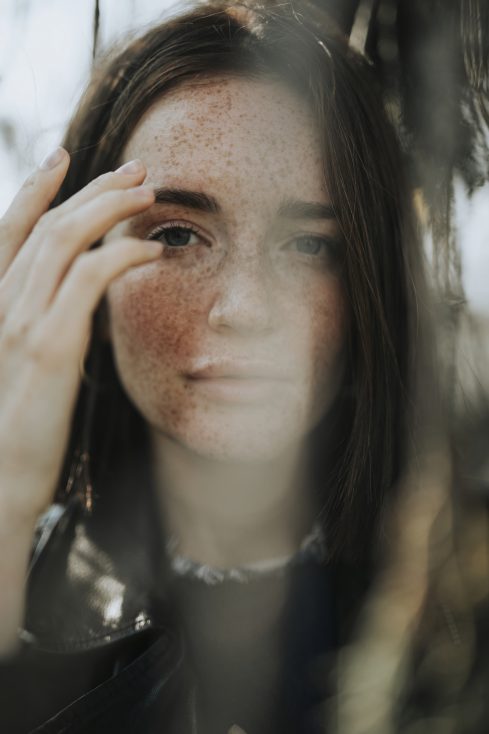 Freckled woman